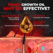 Beardo Beard Growth Set