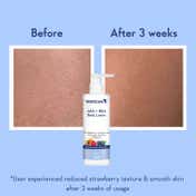 WishCare AHA + BHA Exfoliating Body Lotion for Strawberry Skin- For Skin Detan (200 ml x 2)