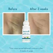 WishCare Aqua Fresh Underarm Roll On Serum-Reduces Pigmentation,Brightens Skin&Prevent Odour(50mlx2)