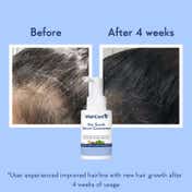 WishCare Hair Growth Serum Concentrate with Redensyl & Rosemary-In-Vivo Tested (30 ml x 2)