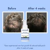 WishCare Hair Growth Serum Concentrate with Redensyl & Rosemary-In-Vivo Tested (30 ml x 4)