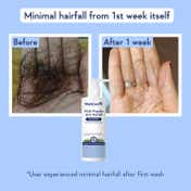 WishCare Multi Peptide Anti Hairfall Shampoo & Conditioner - Boosts Hair Growth (250 ml + 200 ml)