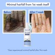 WishCare Multi Peptide Anti Hairfall Shampoo & Conditioner - Boosts Hair Growth (250 ml + 200 ml)