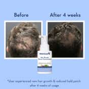 WishCare Hair Growth Serum Concentrate & Multi Peptide Anti Hairfall Shampoo Combo(30ml+250ml+200ml)