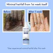 WishCare Hair Growth Serum Concentrate & Multi Peptide Anti Hairfall Shampoo Combo(30ml+250ml+200ml)