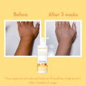 WishCare Sunscreen Body Lotion & Niacinamide Oil Balance Fluid Sunscreen SPF 50 Combo (200ml + 50ml)