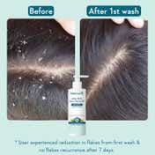 WishCare Hydrating AHA BHA Anti Dandruff Shampoo & Ceramide Conditioner (250 ml + 200 ml)