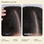 Arata Anti-Dandruff Shampoo (200 ml) Combo