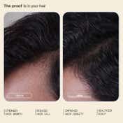 Arata Hair Growth Intensive Serum (30 ml) Combo