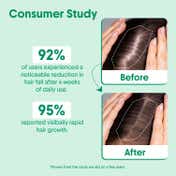 Aravi Organic Hair Boost Duo - Rosemary Hair Growth Serum & Shampoo Pack of 2 Combo