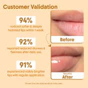 Aravi Organic Lip Glowy Balm With SPF 50 PA+++ - Kojic Acid & Ceramide Pack of 2 Combo