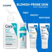 CeraVe Post-Acne Care For Reducing Acne Marks & Uneven Skin Tone Combo