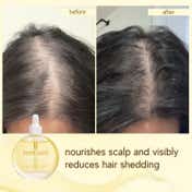 Inde Wild Champi Bond Repair Ritual Combo