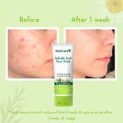 Wishcare AM Skincare Routine With Face Wash, Moisturizer And Sunscreen Oily & Sensitive Skin Combo