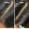 L'OREAL PROFESSIONNEL Scalp Anti-Oiliness Shampoo (300 ml), 2-In-1 Deep Purifier Clay (250 g) Combo