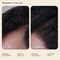 Arata Hair Growth Intensive Serum (30 ml) Combo