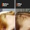 Minimalist Hair Growth Actives 18 % Hair Serum (30 ml) Combo pack of 2