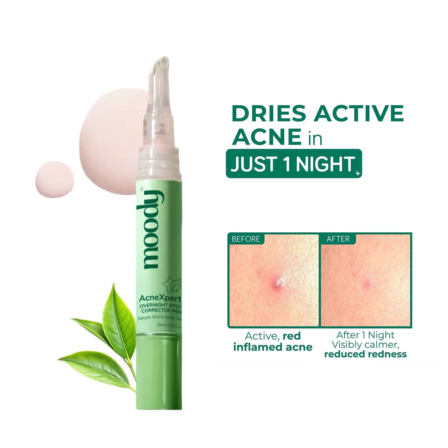 Moody | Moody Acnexpert Overnight Spot Correcting Pen with Salicylic Acid And Green Tea (10 ml)