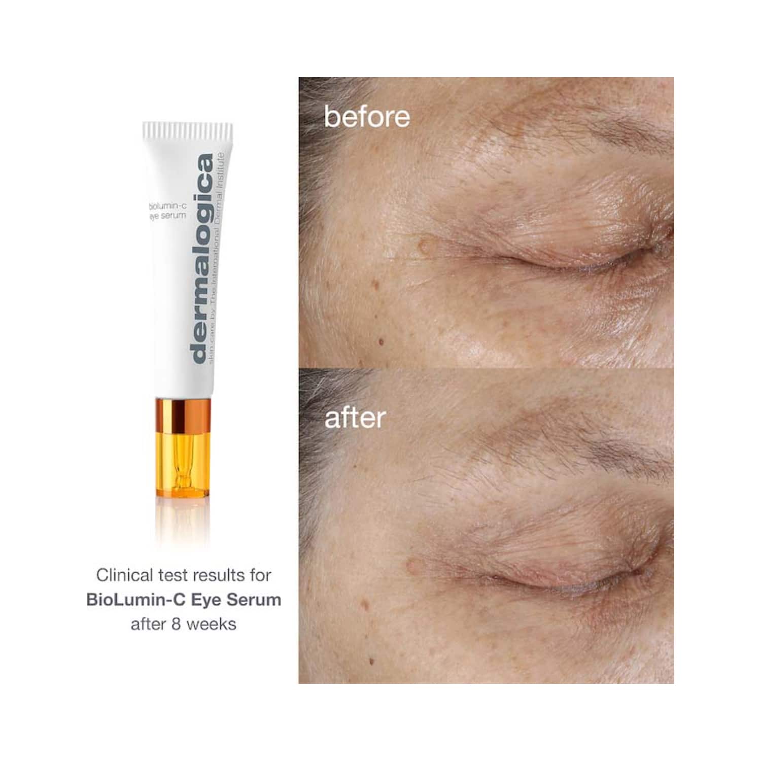 Buy Dermalogica Biolumin C Eye Serum 15ml Online at Best Price