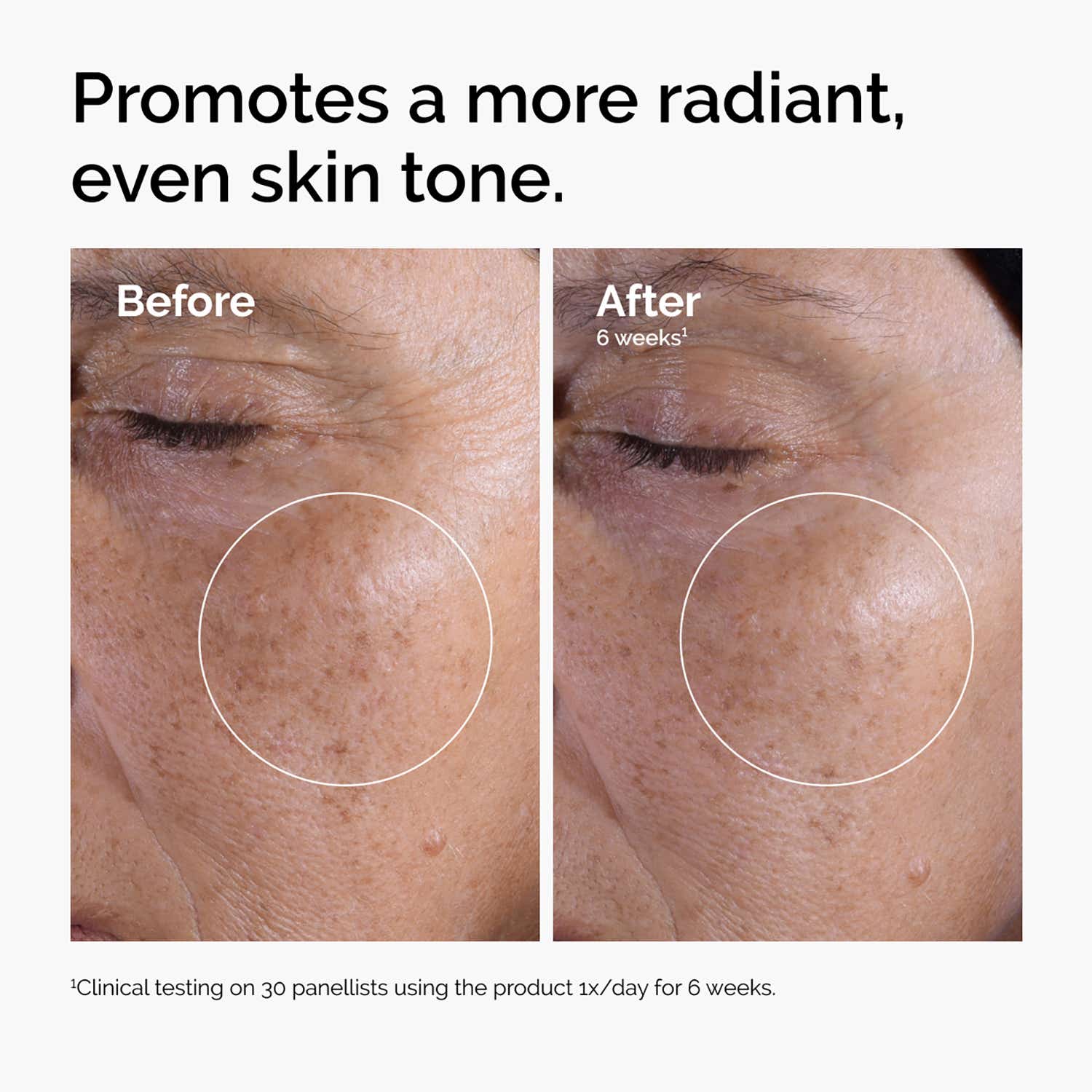 The Ordinary Skin Brightening Duo Combo 30 ml - Image 8