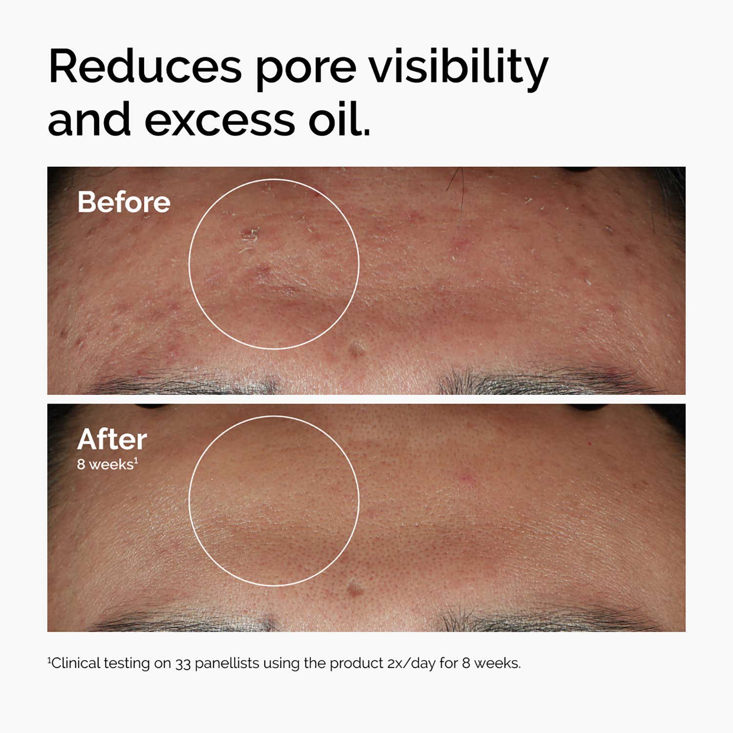 The Ordinary Skin Brightening Duo Combo 30 ml - Image 3