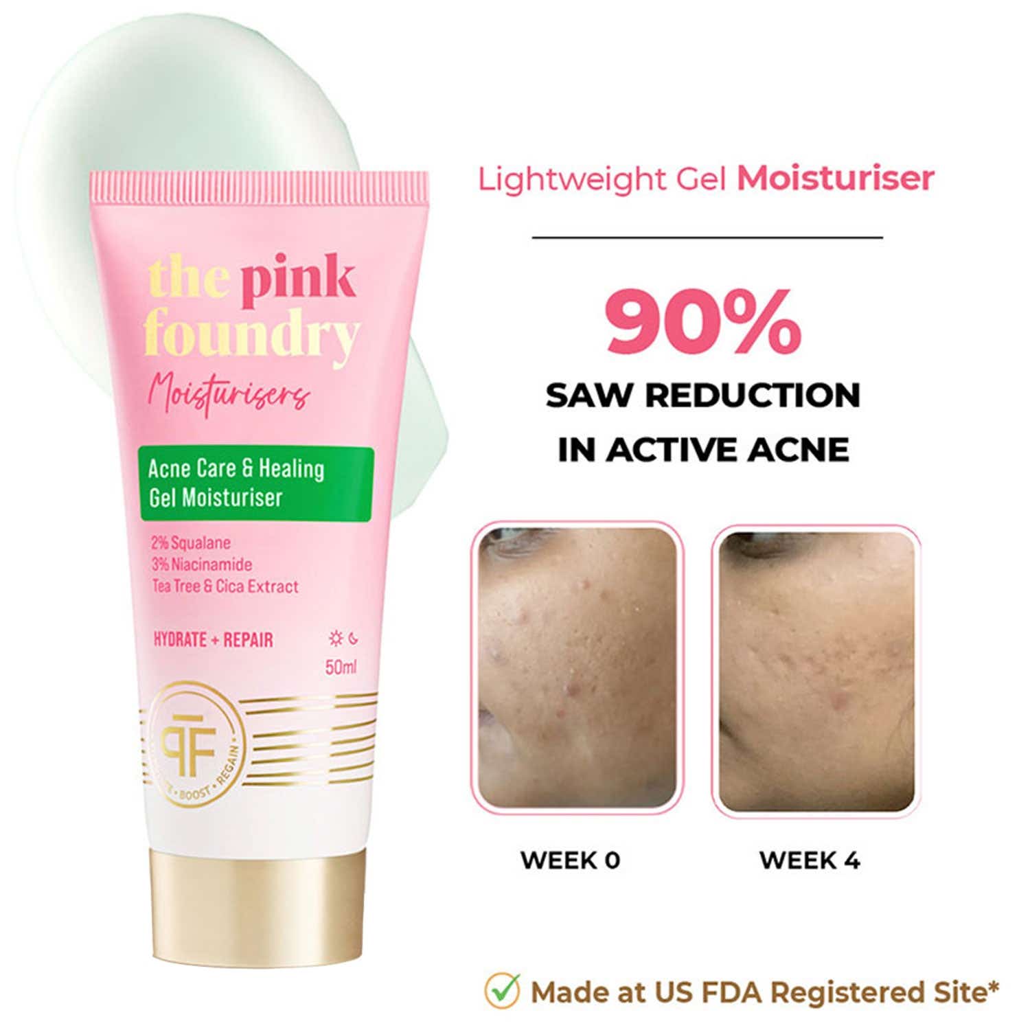 The Pink Foundry | The Pink Foundry Acne Care & Healing Gel Moisturiser (50ml)