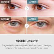 Dr.Melaxin Tx-Retinalsome Double Effect Eye Cream (40 g)