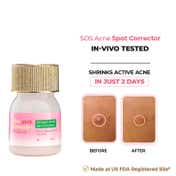The Pink Foundry Overnight Acne Spot Corrector (15ml)