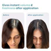 WishCare Air Powder Dry Shampoo for Oily Hair and Scalp No White Cast Instant Volume Boost (10 g)