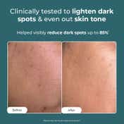 Conscious Chemist Pigmentation Corrector Cream for Dark Spots Remover & Uneven Skin Tone (50gm)