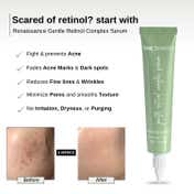 The Formularx Gentle Retinol Night Serum for Acne Dark Spots Enlarged Pores & Anti-Aging (30 g)