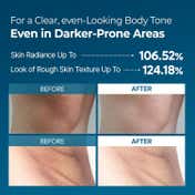 Dr.Melaxin Peel Shot Exfoliating Tx-Spray (200 ml)