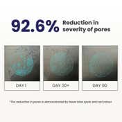 Re'equil 0.3% Retinol Night Cream Improves Skin Texture & Reduces Acne (32 g)