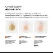 Minimalist 2% Alpha Arbutin Face Serum With Hyaluronic Acid Reduces pigmentation & dark spots (30ml)
