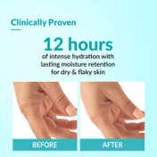Fixderma Moisturizing Cream For Dry & Chapped Skin, Provides Hydration and Moisturization (60g)