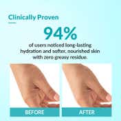 Fixderma Moisturizing Lotion for Dry Skin Daily Moisturizer Provides Hydration & Calmness (150ml)