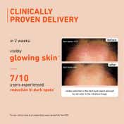 Plum 15% Vitamin C Glow Face Serum Dermat Tested Fight Dark Spots, Pigmentation & Dull Skin (20ml)