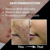 House of Beauty Pigmentation Serum For Uneven Skin, Reduces Melanin Production W-T Niacin (30 ml)