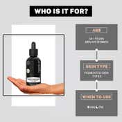 House of Beauty Pigmentation Serum For Uneven Skin, Reduces Melanin Production W-T Niacin (30 ml)