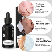 House of Beauty Pigmentation Serum For Uneven Skin, Reduces Melanin Production W-T Niacin (30 ml)