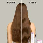 SP Balance Scalp Anti-Dandruff Shampoo for Delicate Scalps (250 ml)