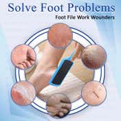 Majestique Foot & Nail File Rasp (Color May Vary)