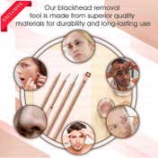 Majestique Blackhead Remover kit 4Pcs, Blackhead Extractor Tool for Nose Face