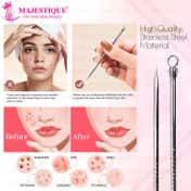 Majestique Whitehead And Blackhead Extractor And Remover