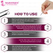 Majestique Whitehead And Blackhead Extractor And Remover