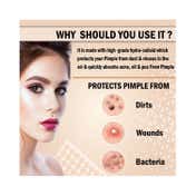 Urban Yog Acne Pimple Patch (72Pcs)