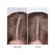 Moroccanoil Dry Scalp Hair Treatment (45ml)