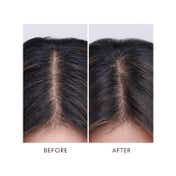 Moroccanoil Oily Scalp Hair Treatment (45ml)