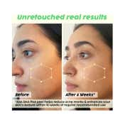 Plix 25% AHA + 2% BHA + 5% PHA Peeling Solution (30ml)