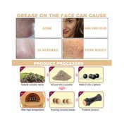 Bronson Professional Oil Absorbing Volcanic Face Roller - Black (1 pc)